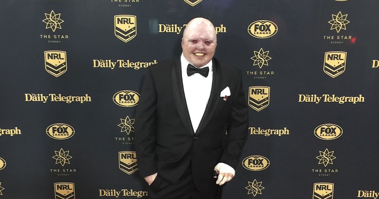 Dean's brave fight defies doctors' expectations